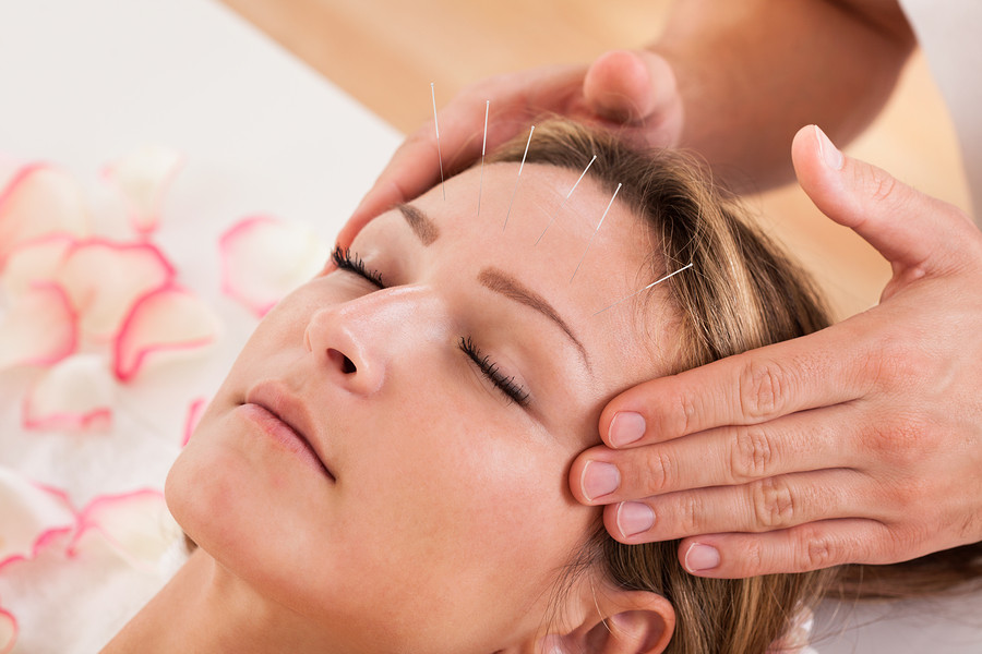 What is Acupuncture?